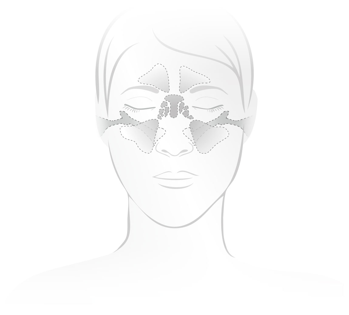 Therapie der oberen Atemwege mit dem RC-Cornet® PLUS NASAL
